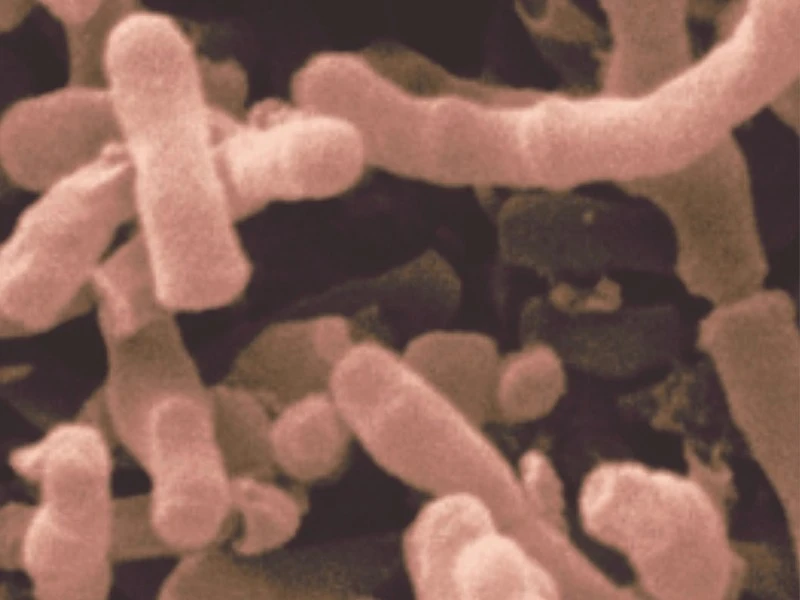 Bifidobacterium animalis Bifidobacterium animalis